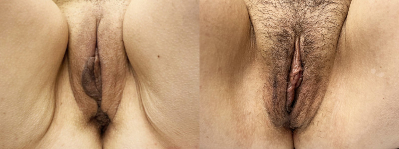 mergedBeforeAfterImage