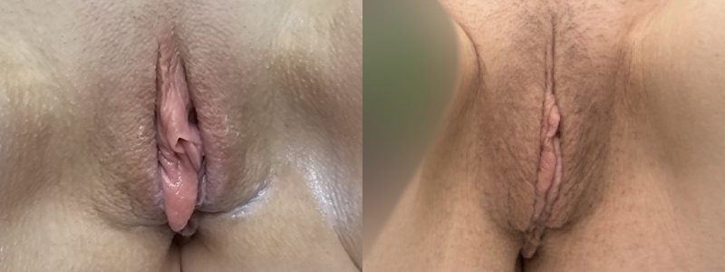 mergedBeforeAfterImage