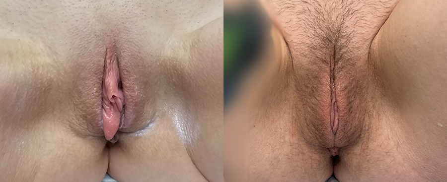 mergedBeforeAfterImage