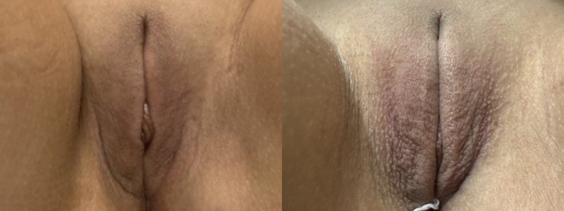 mergedBeforeAfterImage