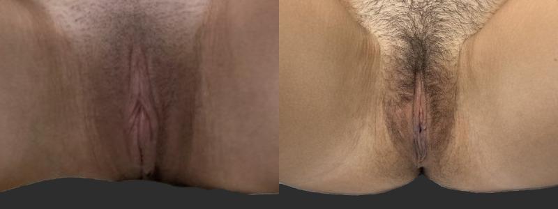 mergedBeforeAfterImage